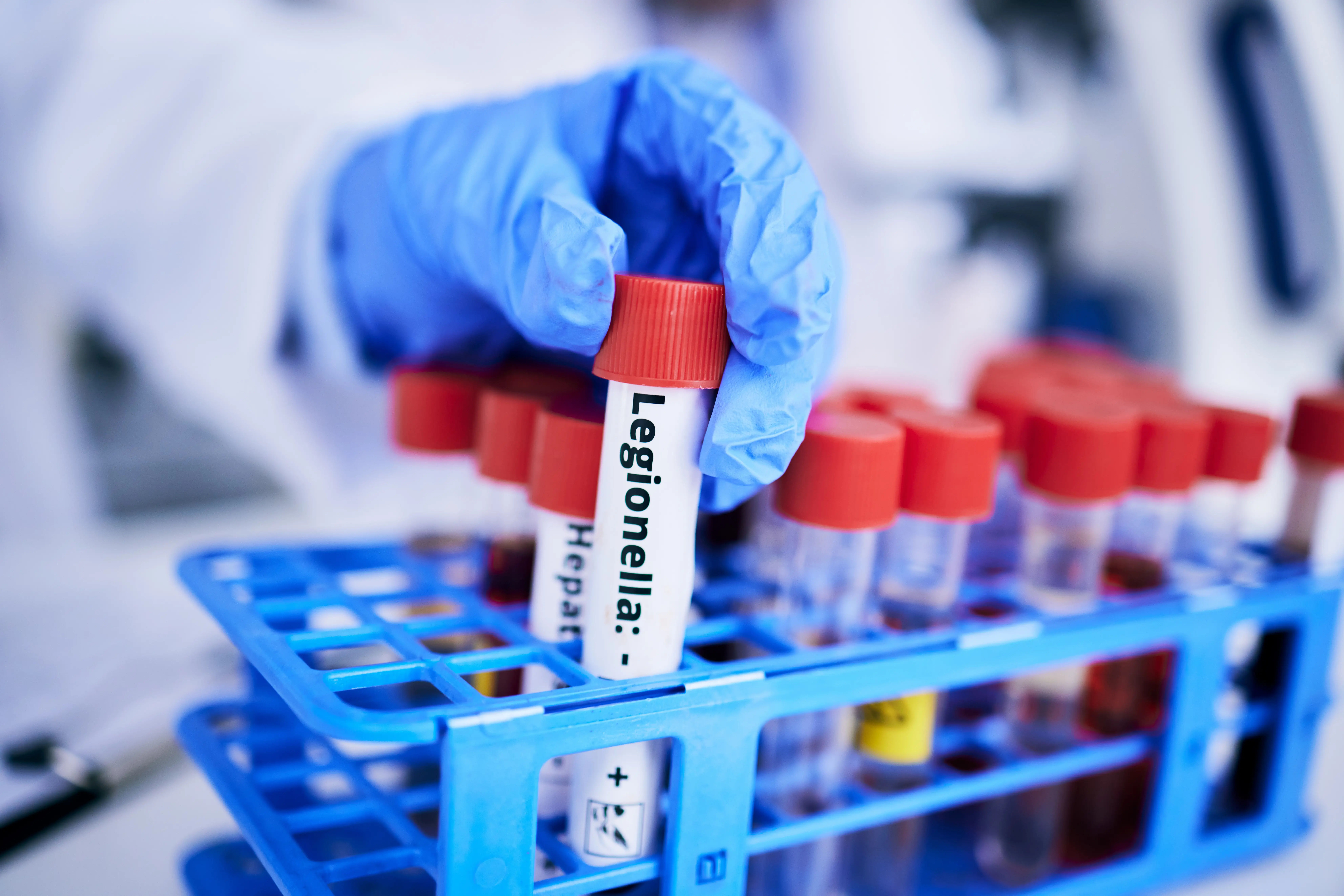 Understanding the Root Cause The Legionella Bacterium